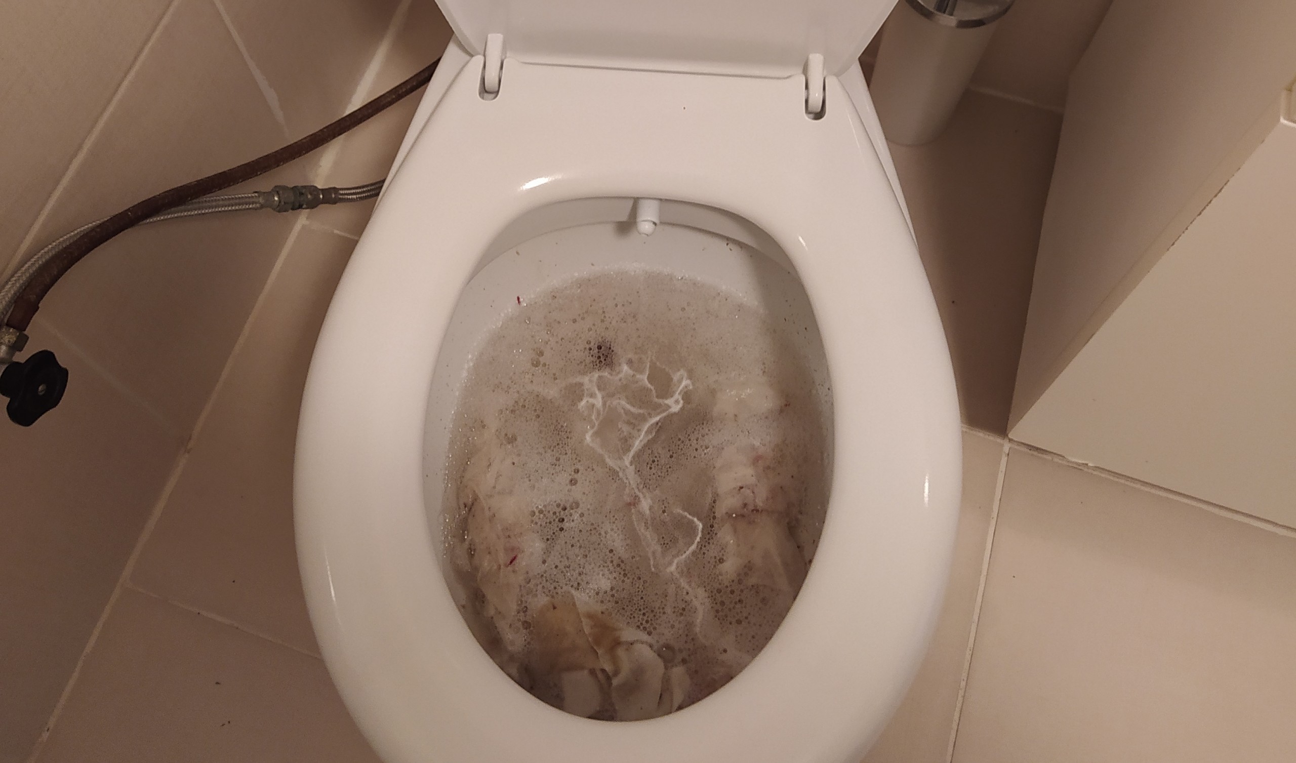 Tuvalet Tıkanıklığını Ne Açar?